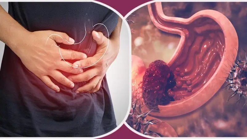 পেটের এই লক্ষণ হতে পারে ক্যানসারের ইঙ্গিত! কখন সতর্ক হবেন?