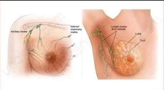 মেয়েদের যে আট ভুলের কারনে হচ্ছে স্তন ক্যান্সার!