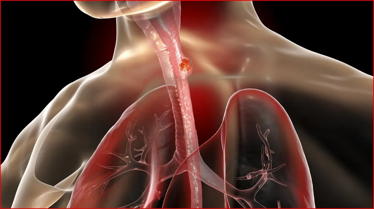 ক্যান্সার হওয়ার এক বছর আগেই শরীর যে সংকেত দেয়