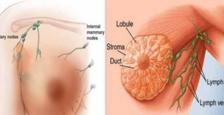 মেয়েদের এই ৮টি ভুলের কারনে হচ্ছে স্তন ক্যা”ন্সার, প্রত্যেক মেয়েদের পড়া উচিৎ