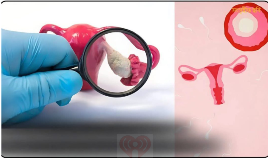 ৩ টি লক্ষণ থাকলে কখনো সন্তান হবে না