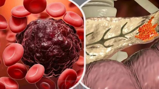 কোন রক্তের গ্রুপের মানুষের ক্যান’সারের ঝুঁ’কি বেশি হয়!