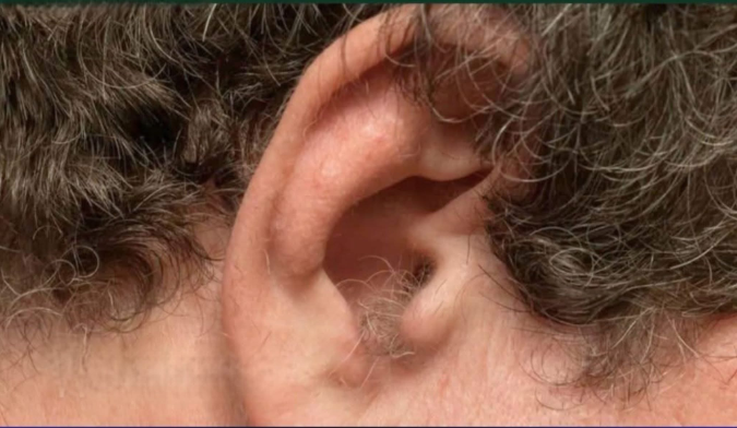 কানে চুল গজানো কিসের ই’ঙ্গিত? বিশেষজ্ঞরা যা বলছেন!