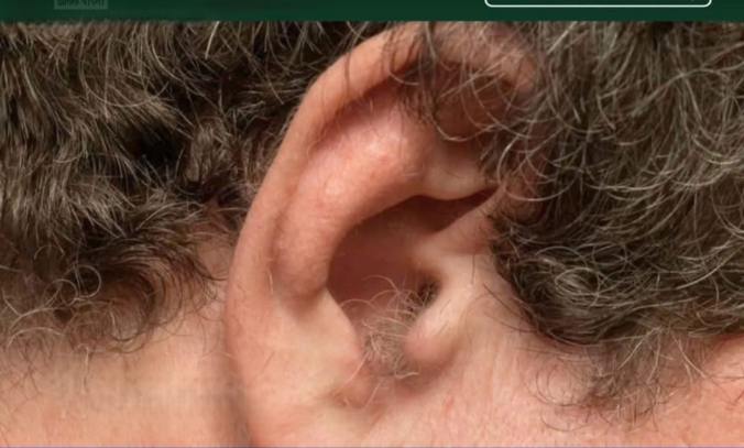 কানে চুল গজানো কিসের ই’ঙ্গিত? বিশেষজ্ঞরা যা বলছেন!
