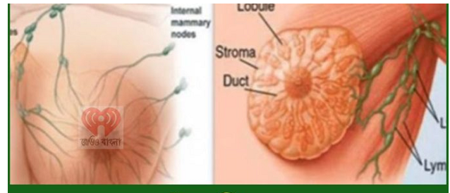 মেয়েদের এই ৮টি ভুলের কারণে হচ্ছে স্ত’ন ক্যা’ন্সার! প্রত্যেক মেয়েদের পড়া উ’চিৎ!