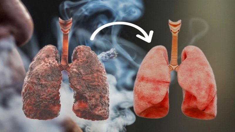 অতিরিক্ত ধূমপানে ফুসফুস ক্ষতিগ্রস্ত! নিয়মিত খান এই ৬ খাবার